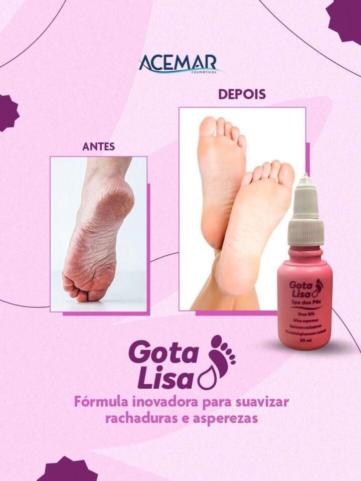 Gota Lisa - Acemar 