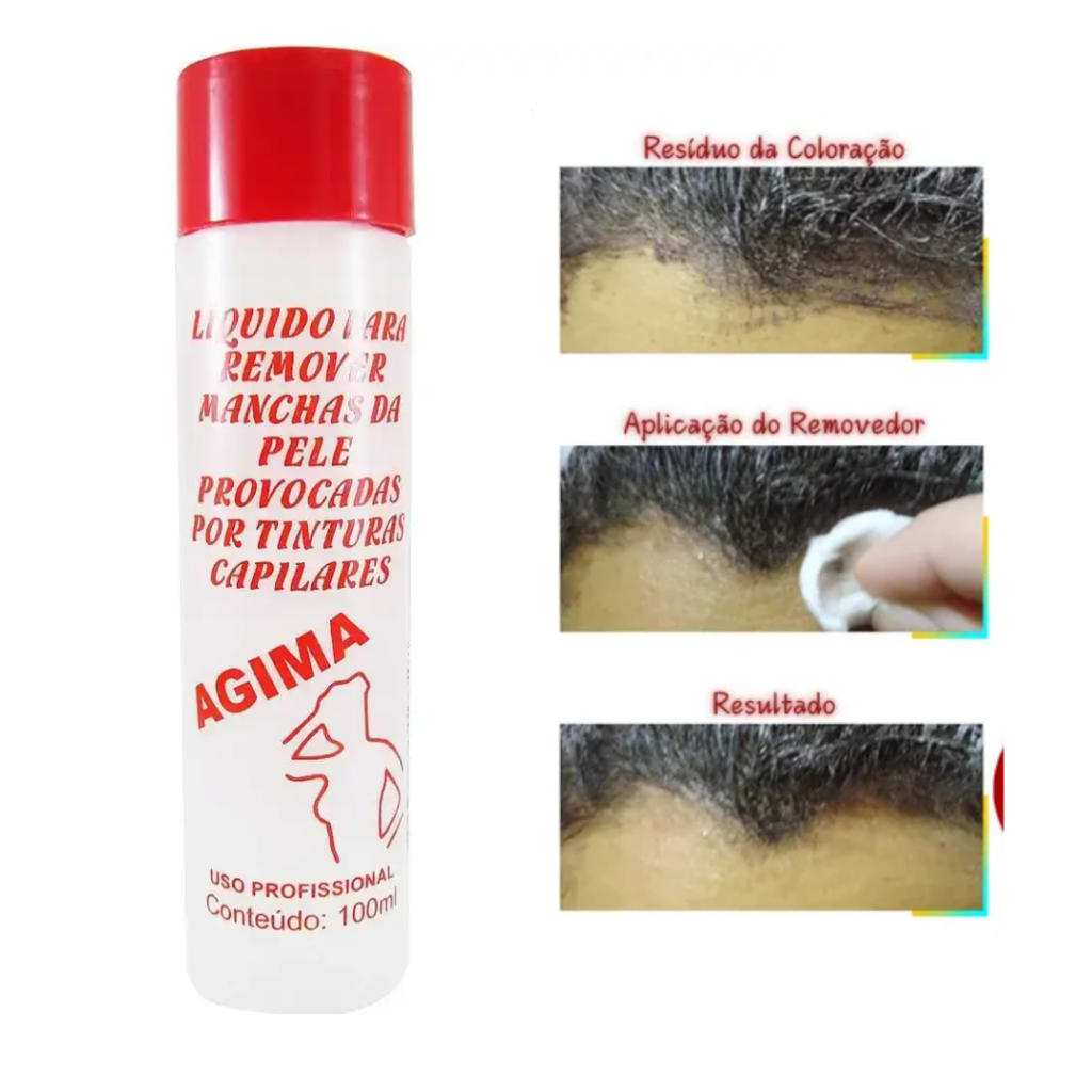 Tira Manchas Agima 100ml  