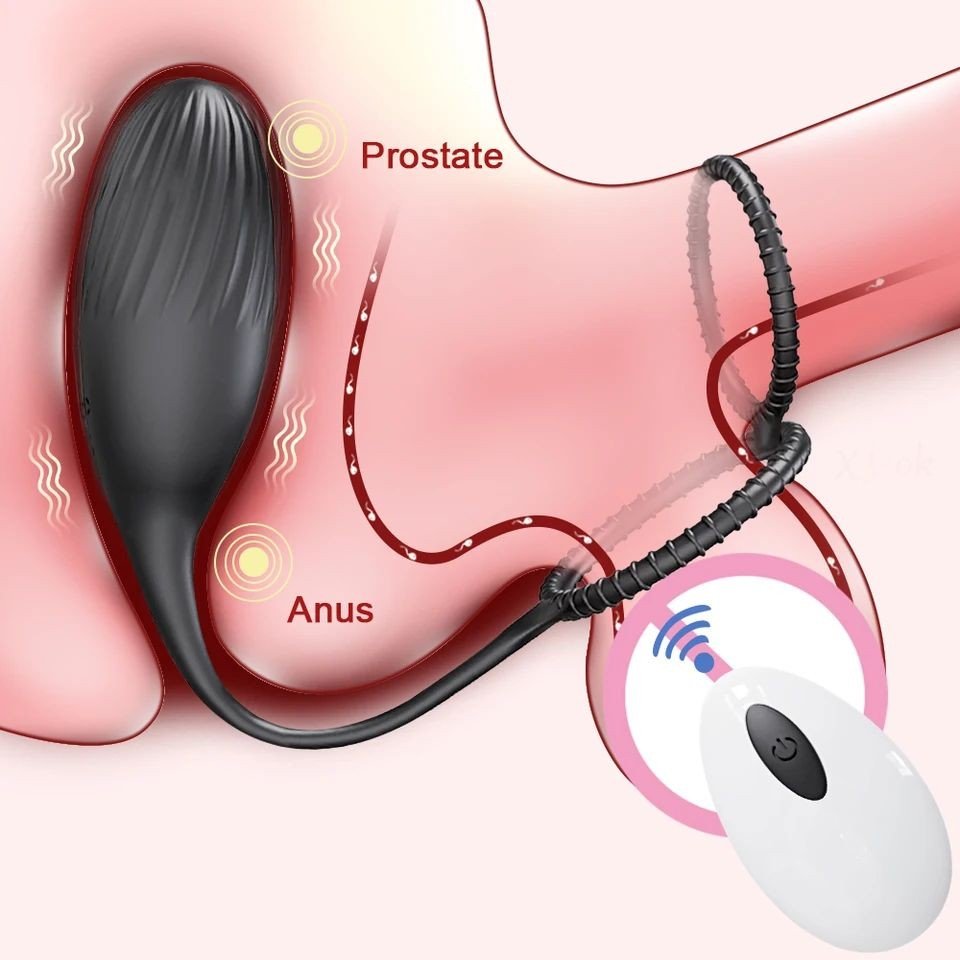 ºPLUG ANAL COM VIBRADOR , ANEL DUPLO E CONTROLE A DISTÂNCIA